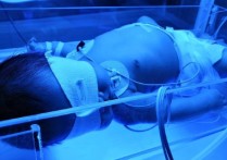 什么是篮光治疗 新生儿得了黄疸，医院建议照蓝光，什么是蓝光治疗？