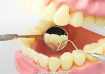 牙髓摘除有什么危害 什么是牙髓摘除术？活髓切断术