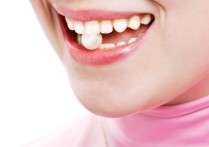 用什么会让牙齿变白 怎么样才能使牙齿变白?