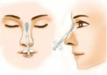 注射隆鼻注意什么 注射类隆鼻后需要注意什么？