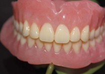 什么固定假牙最好用 装假牙哪种好 镶什么牙好