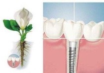 种牙后手术区会有什么症状 种植牙手术后恢复需要注意什么呢