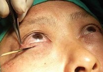 做眼袋手术有什么风险 做下眼袋手术有危险吗？